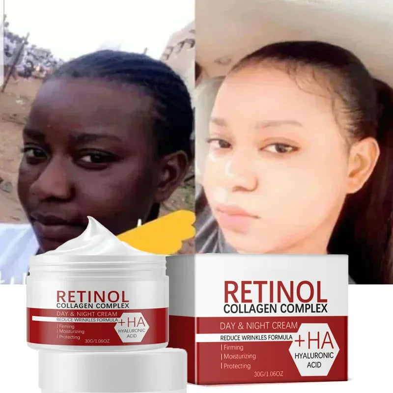 Face Body Whitening Cream Retinol Collagen Hyaluronic Acid 3in1 Remove Dark Spots Eliminate Melanin Dispel Acne Lighten The Skin