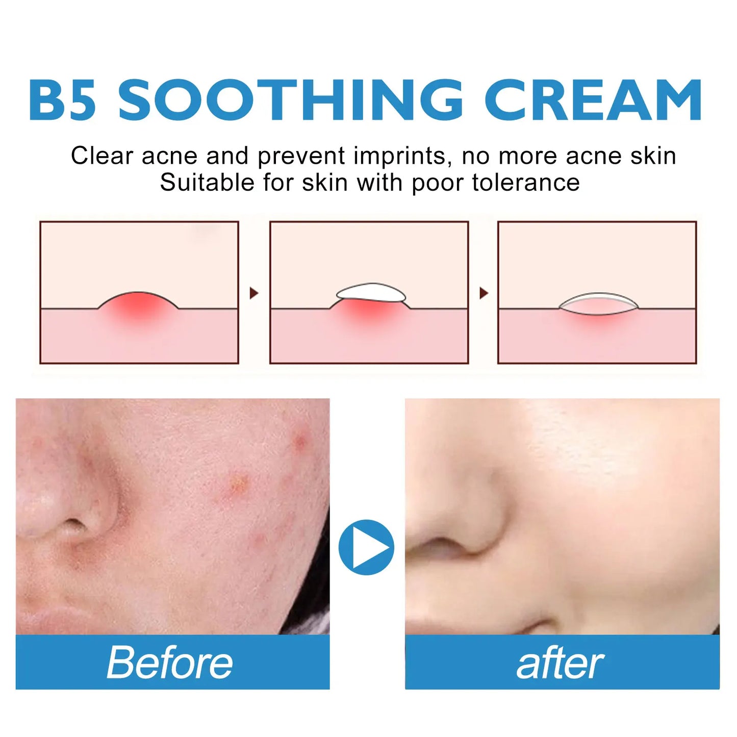 B5 Repair Cream Moisturizing Hydrating Soothing Dry Chapped Redness Skin Nourishes Improve Sunscreen Beauty Face Cream Skin Care
